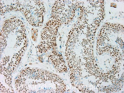 Immunohistochemistry (Formalin/PFA-fixed paraffin-embedded sections) - Anti-HSF1 antibody [10H8] (AB61382), expandable thumbnail