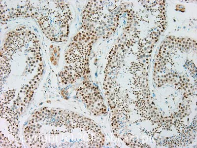 Immunohistochemistry (Formalin/PFA-fixed paraffin-embedded sections) - Anti-HSF1 antibody [10H8] (AB61382)