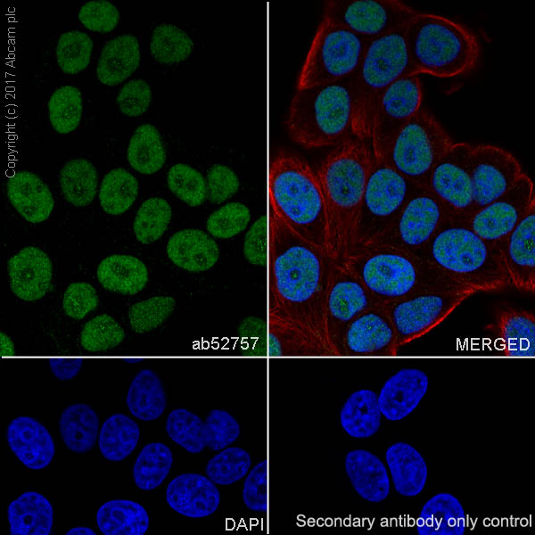 Immunocytochemistry/ Immunofluorescence - Anti-HSF1 antibody [EP1710Y] - BSA and Azide free (AB232342), expandable thumbnail
