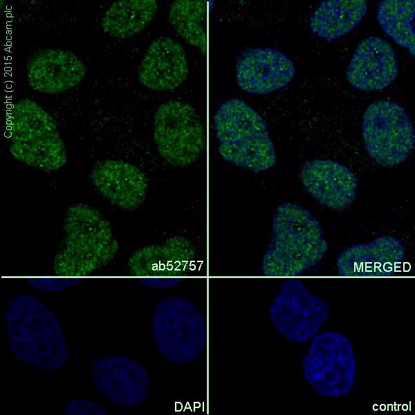 Immunocytochemistry/ Immunofluorescence - Anti-HSF1 antibody [EP1710Y] - BSA and Azide free (ab232342), expandable thumbnail
