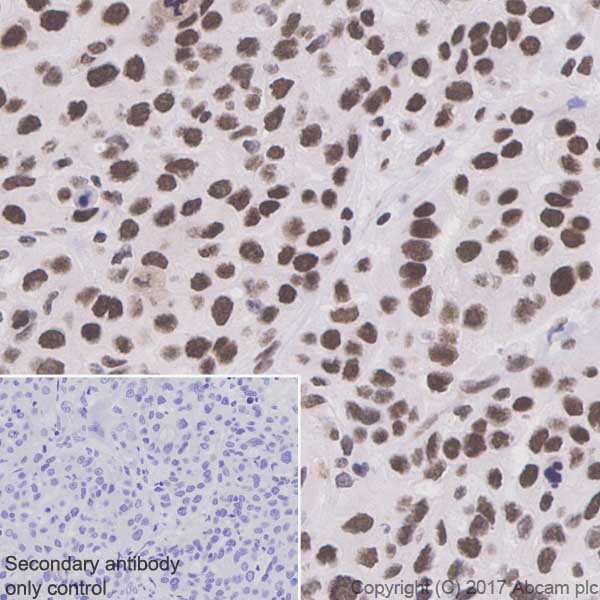 Immunohistochemistry (Formalin/PFA-fixed paraffin-embedded sections) - Anti-HSF1 antibody [EP1710Y] - BSA and Azide free (AB232342), expandable thumbnail