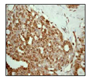 Immunohistochemistry (Formalin/PFA-fixed paraffin-embedded sections) - Anti-HSF1 antibody [EP1710Y] - BSA and Azide free (AB232342)