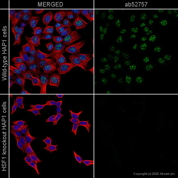Immunocytochemistry/ Immunofluorescence - Anti-HSF1 antibody [EP1710Y] - ChIP Grade (AB52757)