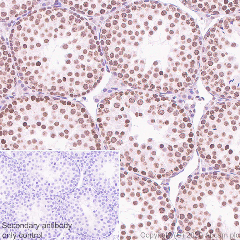 Immunohistochemistry (Formalin/PFA-fixed paraffin-embedded sections) - Anti-HSF1 antibody [EP1710Y] - ChIP Grade (AB52757)