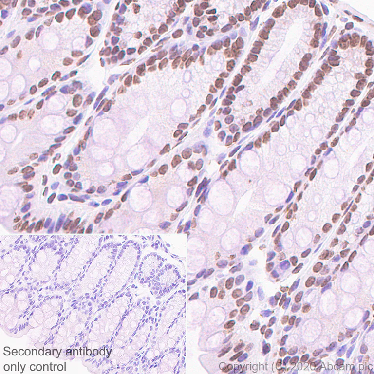 Immunohistochemistry (Formalin/PFA-fixed paraffin-embedded sections) - Anti-HSF1 antibody [EP1710Y] - ChIP Grade (AB52757)
