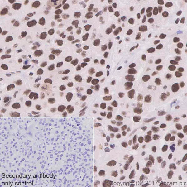 Immunohistochemistry (Formalin/PFA-fixed paraffin-embedded sections) - Anti-HSF1 antibody [EP1710Y] - ChIP Grade (AB52757)