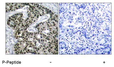 Immunohistochemistry (Formalin/PFA-fixed paraffin-embedded sections) - Anti-HSF1 (phospho S303) antibody (AB47369)