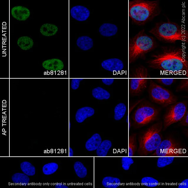 Immunocytochemistry - Anti-HSF1 (phospho S303 + S307) antibody [EP1711Y] (AB81281)