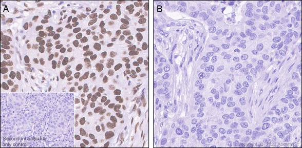 Immunohistochemistry (Formalin/PFA-fixed paraffin-embedded sections) - Anti-HSF1 (phospho S303 + S307) antibody [EP1711Y] - BSA and Azide free (AB284770)