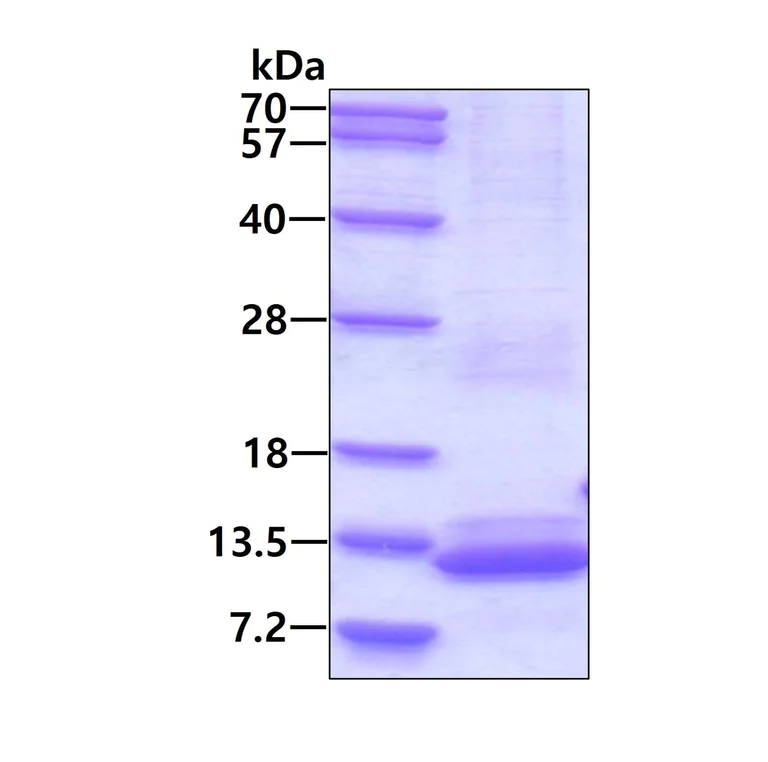 SDS-PAGE - Anti-HSF1 (phospho S303 + S307) antibody [EP1711Y] - BSA and Azide free (AB284770)