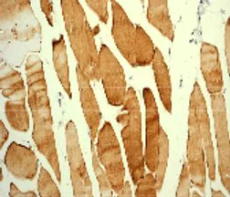 Immunohistochemistry (Formalin/PFA-fixed paraffin-embedded sections) - Anti-HSF1 (phospho S320) antibody [EPR1712] (AB76183)