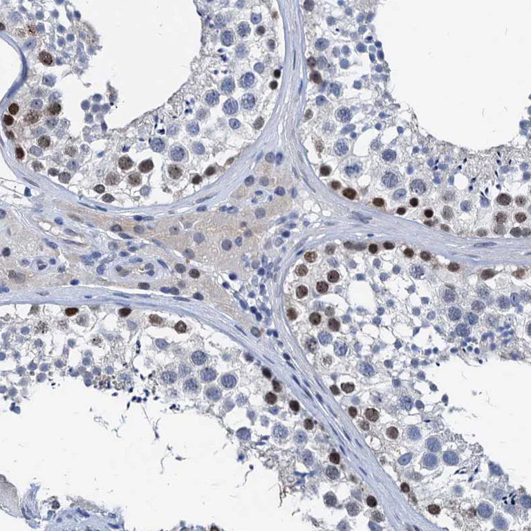 Immunohistochemistry (Formalin/PFA-fixed paraffin-embedded sections) - Anti-HSF2 Antibody (AB327221)