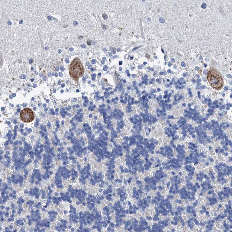 Immunohistochemistry (Formalin/PFA-fixed paraffin-embedded sections) - Anti-HSF2 Antibody (AB327221)