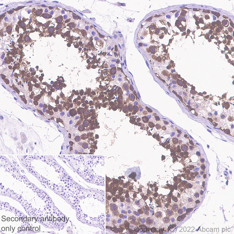Immunohistochemistry (Formalin/PFA-fixed paraffin-embedded sections) - Anti-Hsp 90 alpha antibody [EPR27270-11] - BSA and Azide free (AB303517)