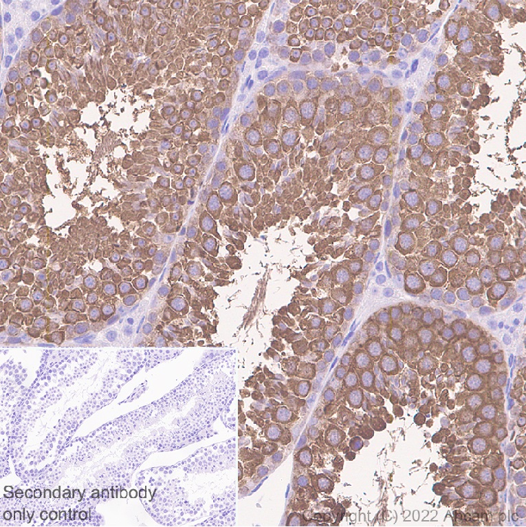 Immunohistochemistry (Formalin/PFA-fixed paraffin-embedded sections) - Anti-Hsp 90 alpha antibody [EPR27270-11] - BSA and Azide free (AB303517), expandable thumbnail
