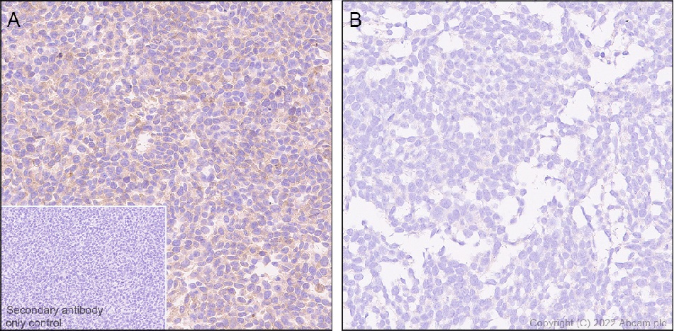Immunohistochemistry (Formalin/PFA-fixed paraffin-embedded sections) - Anti-Hsp 90 alpha antibody [EPR27270-11] - BSA and Azide free (AB303517), expandable thumbnail