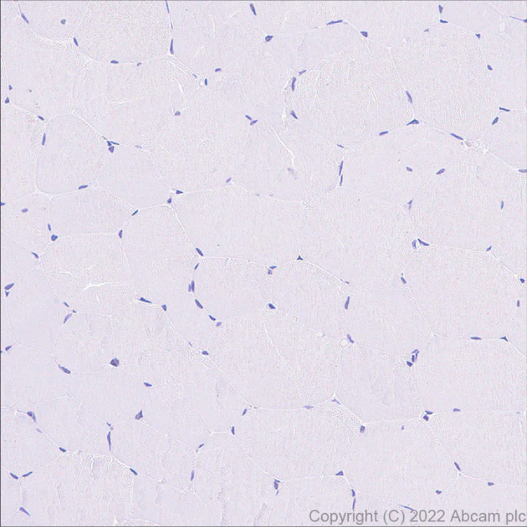 Immunohistochemistry (Formalin/PFA-fixed paraffin-embedded sections) - Anti-Hsp 90 alpha antibody [EPR27270-11] - BSA and Azide free (AB303517)