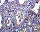Immunohistochemistry (Formalin/PFA-fixed paraffin-embedded sections) - Anti-Hsp105/HSP110 antibody [EPR4576] (AB109624)