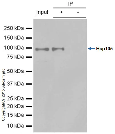 Immunoprecipitation - Anti-Hsp105/HSP110 antibody [EPR4576] (AB109624)