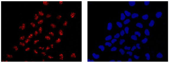 Immunocytochemistry/ Immunofluorescence - Anti-Hsp20 antibody [EPR14457] - BSA and Azide free (AB250977), expandable thumbnail