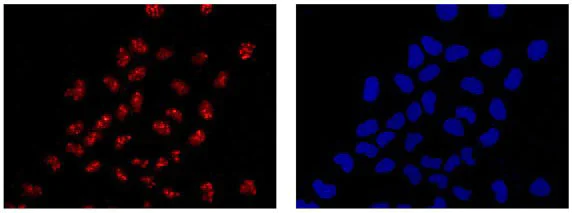 Immunocytochemistry/ Immunofluorescence - Anti-Hsp20 antibody [EPR14457] - BSA and Azide free (AB250977)