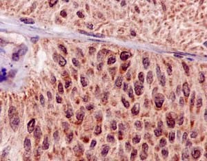 Immunohistochemistry (Formalin/PFA-fixed paraffin-embedded sections) - Anti-Hsp20 antibody [EPR14457] - BSA and Azide free (AB250977), expandable thumbnail