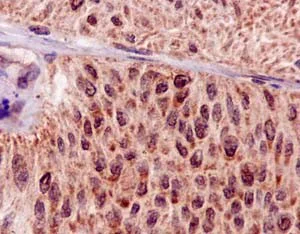 Immunohistochemistry (Formalin/PFA-fixed paraffin-embedded sections) - Anti-Hsp20 antibody [EPR14457] - BSA and Azide free (AB250977)