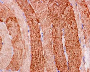 Immunohistochemistry (Formalin/PFA-fixed paraffin-embedded sections) - Anti-Hsp20 antibody [EPR14458] (AB184161)