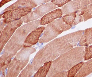 Immunohistochemistry (Formalin/PFA-fixed paraffin-embedded sections) - Anti-Hsp20 antibody [EPR14458] - BSA and Azide free (AB250720)