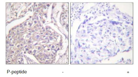 Immunohistochemistry (Formalin/PFA-fixed paraffin-embedded sections) - Anti-Hsp20 (phospho S16) antibody (AB58522)