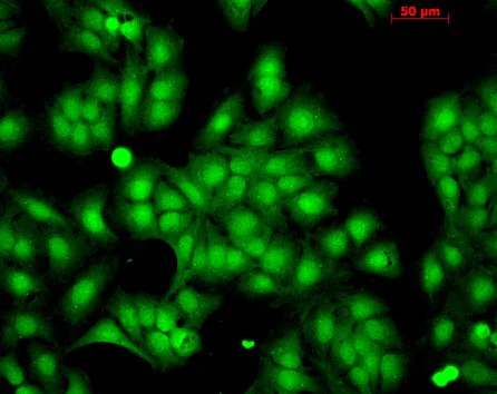 Immunocytochemistry - Anti-Hsp22/HSPB8 antibody (AB79784)