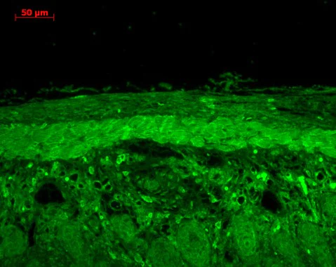 Immunohistochemistry (Formalin/PFA-fixed paraffin-embedded sections) - Anti-Hsp22/HSPB8 antibody (AB79784)