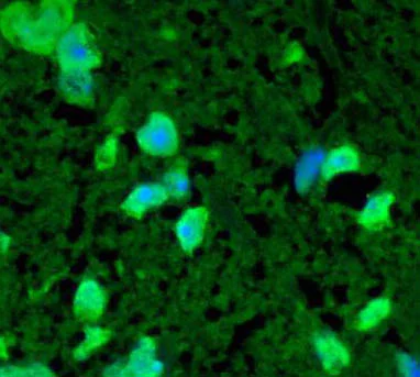 Immunohistochemistry (Formalin/PFA-fixed paraffin-embedded sections) - Anti-Hsp22/HSPB8 antibody (AB79784)