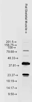Western blot - Anti-Hsp22/HSPB8 antibody (AB79784)