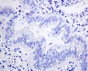 Immunohistochemistry (Formalin/PFA-fixed paraffin-embedded sections) - Anti-Hsp22/HSPB8 antibody [EPR9714] (AB151552)