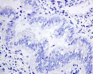Immunohistochemistry (Formalin/PFA-fixed paraffin-embedded sections) - Anti-Hsp22/HSPB8 antibody [EPR9714] (AB151552)