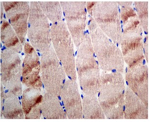Anti-Hsp22/HSPB8 antibody [EPR9714]