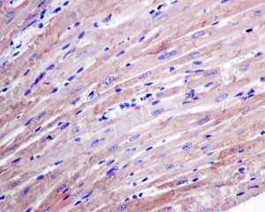 Immunohistochemistry (Formalin/PFA-fixed paraffin-embedded sections) - Anti-Hsp22/HSPB8 antibody [EPR9714] (AB151552)