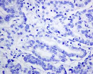 Immunohistochemistry (Formalin/PFA-fixed paraffin-embedded sections) - Anti-Hsp22/HSPB8 antibody [EPR9714] (AB151552)