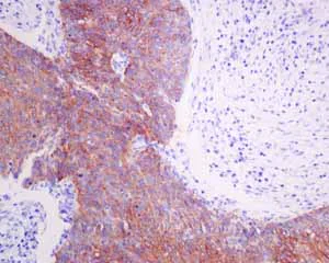 Immunohistochemistry (Formalin/PFA-fixed paraffin-embedded sections) - Anti-Hsp22/HSPB8 antibody [EPR9714] (AB151552)