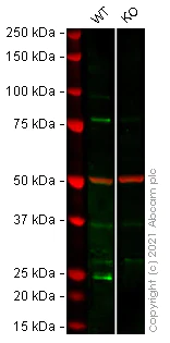 Western blot - Anti-Hsp22/HSPB8 antibody [EPR9714] (AB151552)