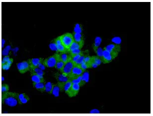 Immunocytochemistry/ Immunofluorescence - Anti-Hsp22/HSPB8 antibody [EPR9714] - BSA and Azide free (AB248999)