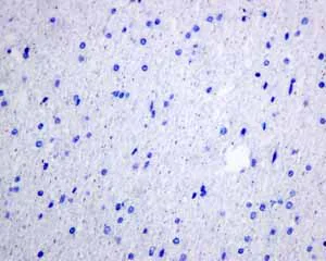 Immunohistochemistry (Formalin/PFA-fixed paraffin-embedded sections) - Anti-Hsp22/HSPB8 antibody [EPR9714] - BSA and Azide free (AB248999)
