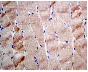 Immunohistochemistry (Formalin/PFA-fixed paraffin-embedded sections) - Anti-Hsp22/HSPB8 antibody [EPR9714] - BSA and Azide free (AB248999)