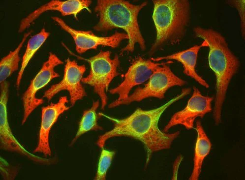 Immunocytochemistry/ Immunofluorescence - Anti-Hsp27 antibody [6H11] (AB190314)