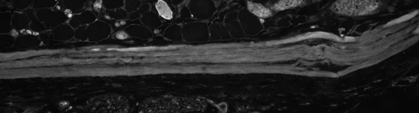 Immunocytochemistry/ Immunofluorescence - Anti-Hsp27 antibody [8A7] (AB79868)