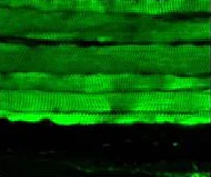 Immunohistochemistry (Formalin/PFA-fixed paraffin-embedded sections) - Anti-Hsp27 antibody [8A7] (AB79868)