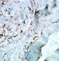 Immunohistochemistry (Formalin/PFA-fixed paraffin-embedded sections) - Anti-Hsp27 antibody [8A7] (AB79868)