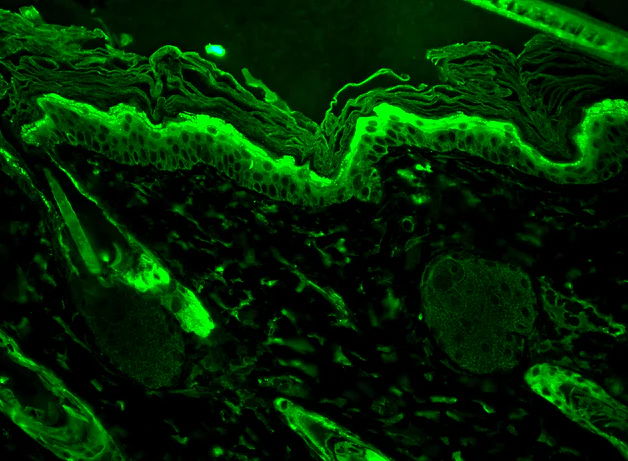 Immunohistochemistry (Formalin/PFA-fixed paraffin-embedded sections) - Anti-Hsp27 antibody [8A7] (AB79868)