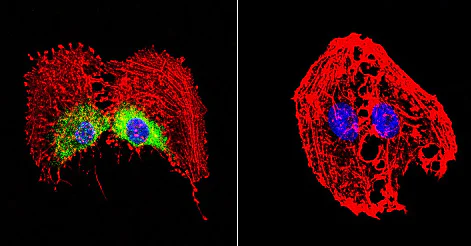 Immunocytochemistry/ Immunofluorescence - Anti-Hsp27 antibody (AB5579)